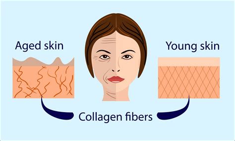 Collagen impact